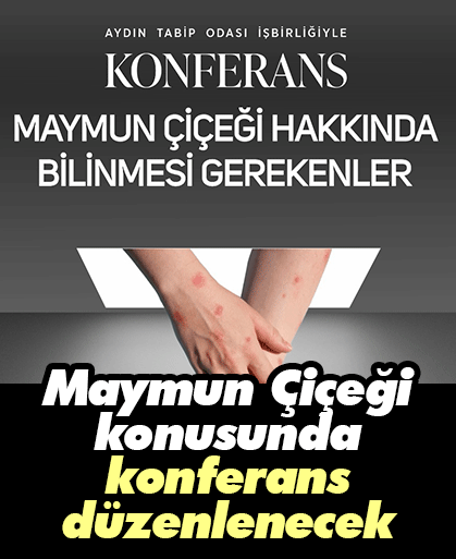 Maymun Çiçeği konusunda konferans düzenlenecek