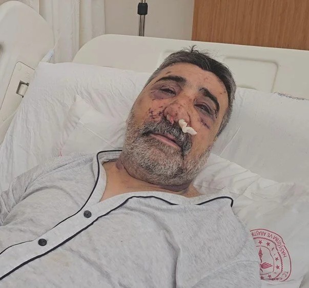 Böyle sapıklık ne görüldü ne duyuldu! İngiliz yolcu öpmeye çalıştığı taksiciyi komalık etti