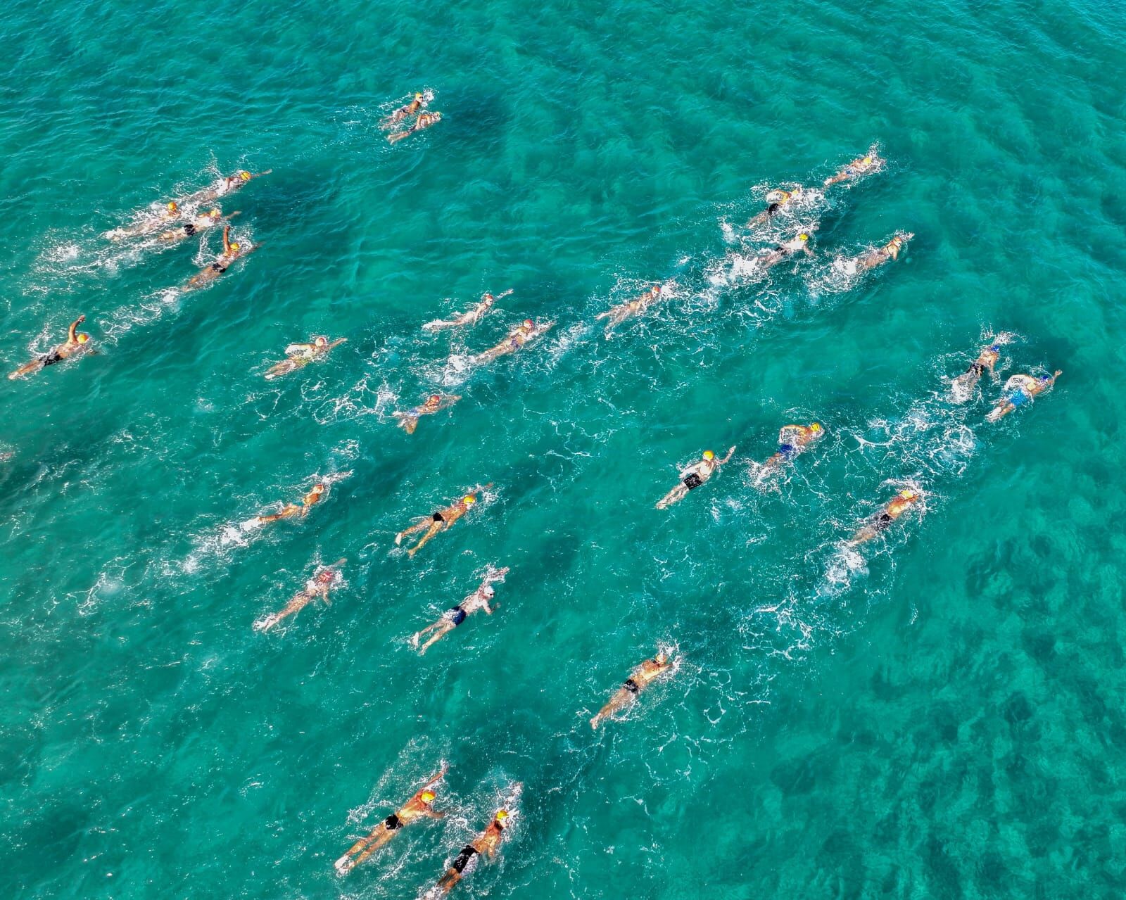 Kusadasinda Kulaclar Otizmli Cocuklar Icin Atildi 602571 Ef6Cb156B0362723Eae1545C7B2695E2