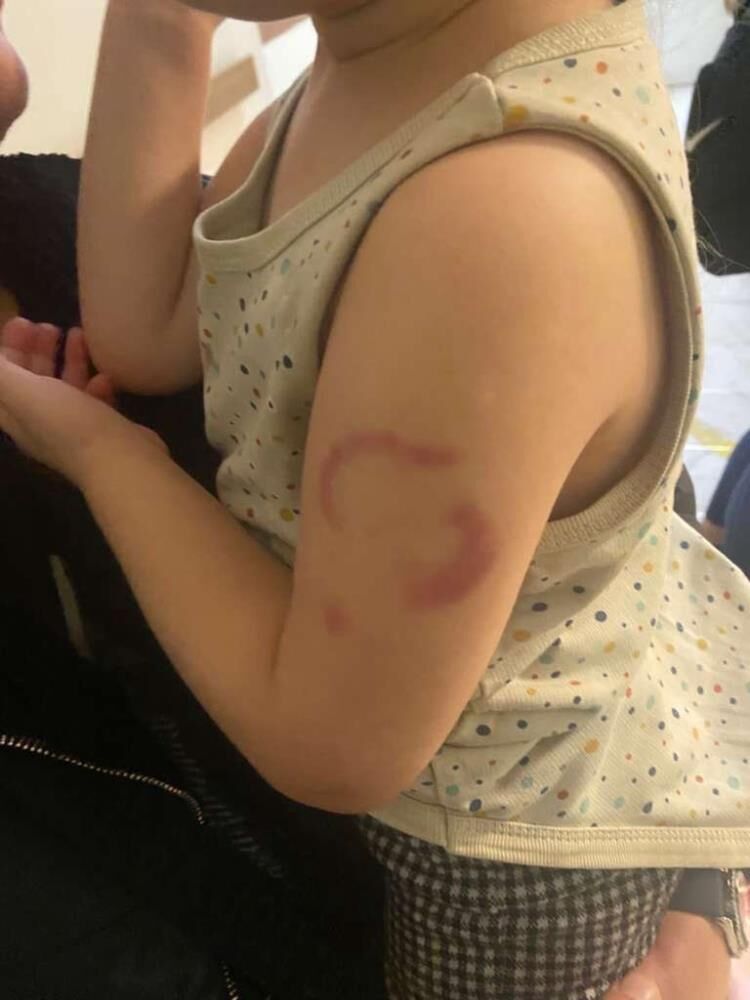 Okulda akılalmaz dehşet! Öğrencisini ısıran öğretmen tutuklandı