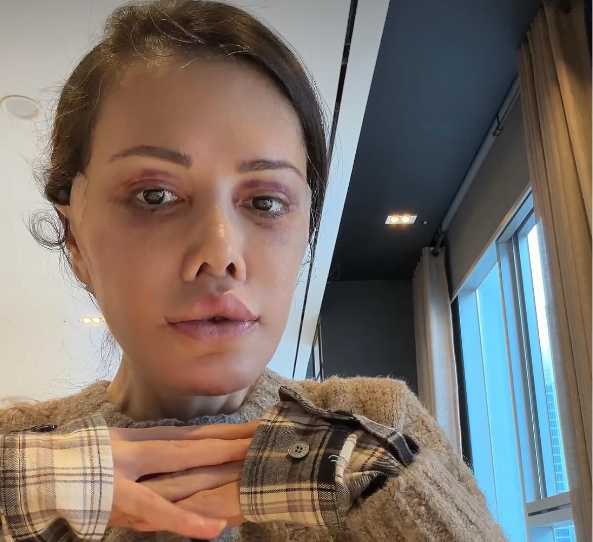 Didem Ceran Estetiği