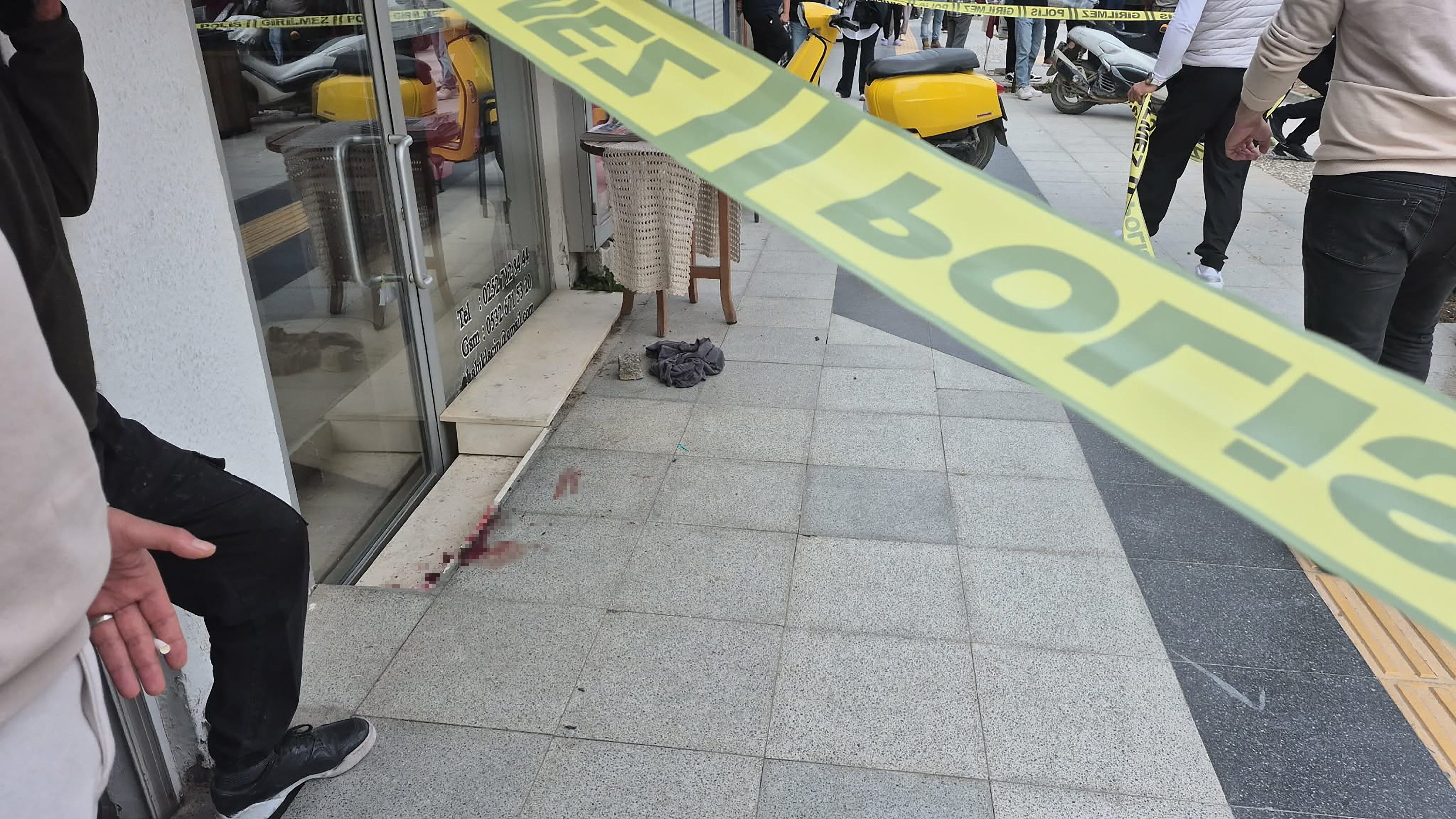 Ak Partili Eski Başkana Saldırı! Hastaneye Kaldırıldı (6)