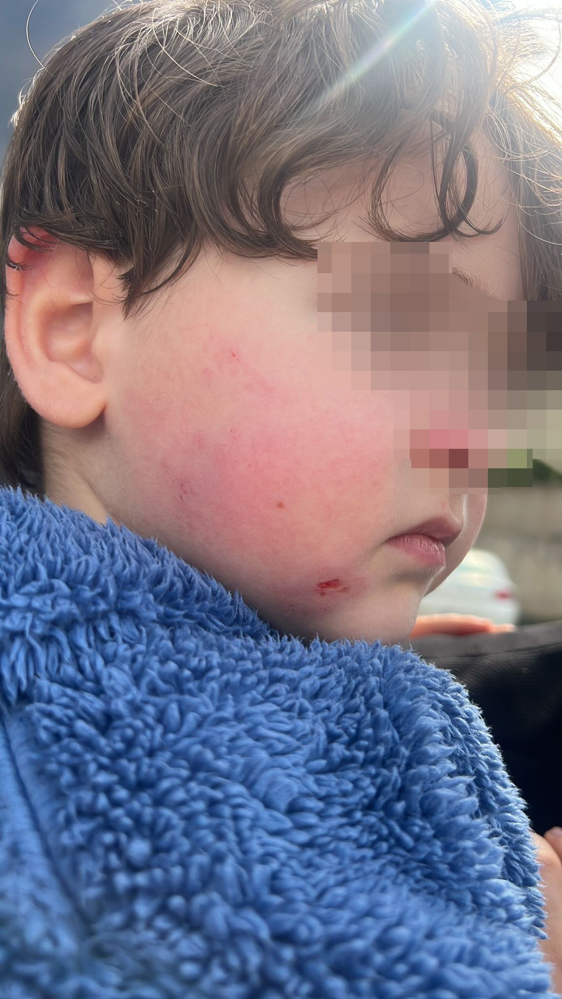 Kreşte Skandal Iddia Aile Çocuğunu Darp Edilmiş Halde Buldu (1)