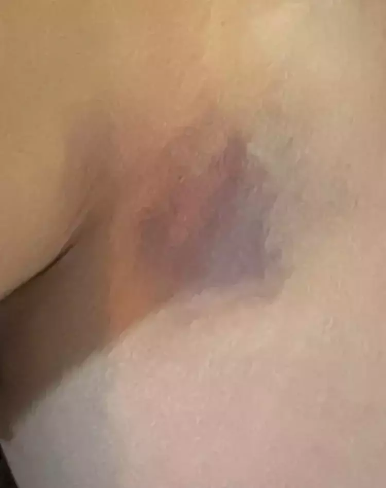 Yıldız Asyalı Şiddet Olayı Ne