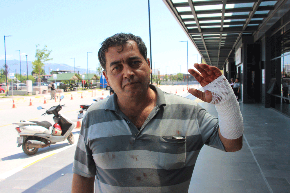 Aydın’da kurban kesimi hastanede bitti! “Hayvana acıyıp kendimi kestim”