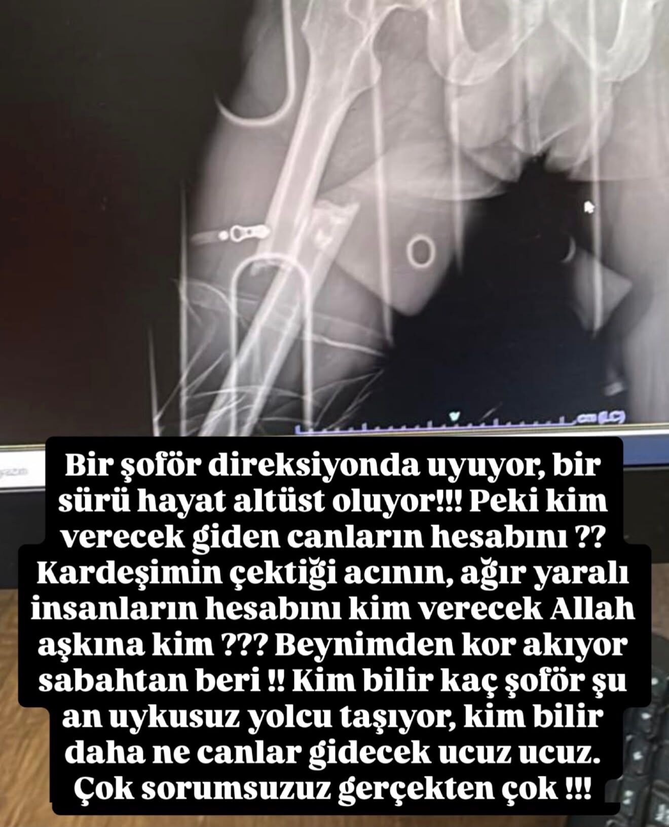Ünlü oyuncunun kardeşi Söke-Milas yolunda kaza yaptı