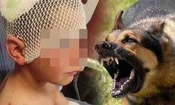 Başıboş köpek çocuğu kafasından ısırdı! Sokakta oynarken dehşeti yaşadı