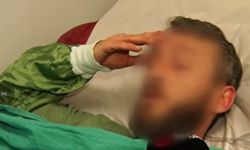 Dayanılmaz öksürükle uyanıp ölümden döndürüldü! Doktorlar gece uyurken yuttuğu şeye inanamadı