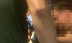 Otobüste üstü çıplak turist şoku! Alkollü veya madde bağımlısı olduğu sanıldı gerçek çok başka çıktı