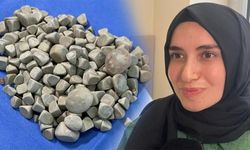 Hepsi genç kızın vücudundan çıkarıldı! Saya saya bitiremeyen doktorlar şok oldu