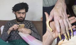 Üç yıldır ne yıkanıyor ne tırnaklarını kesiyor! Telefon bağımlısı genç ailesini kahrediyor